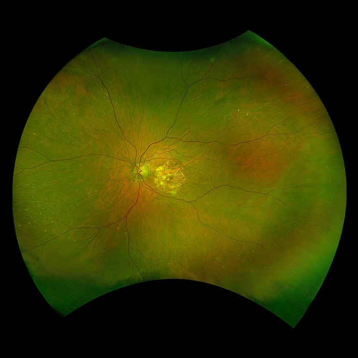 California optomap farbe rg