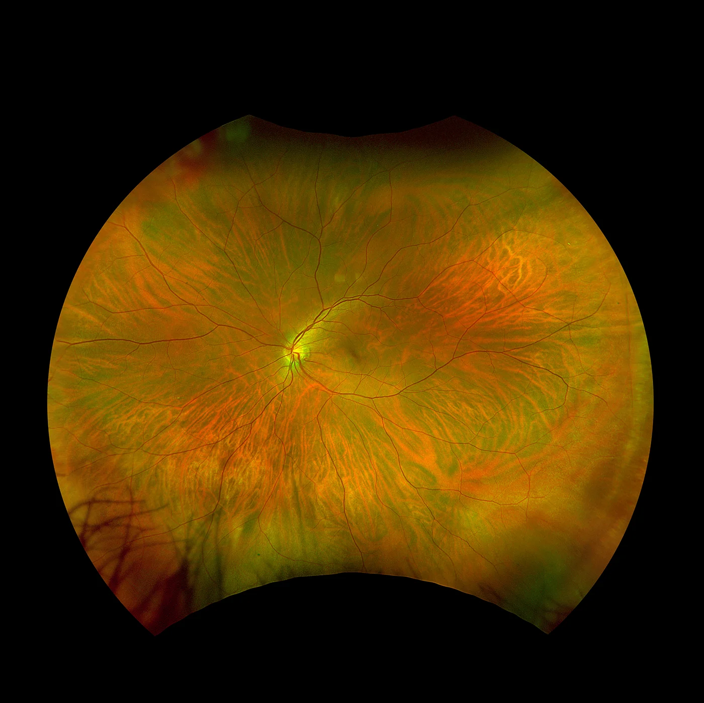 optomap Farbe