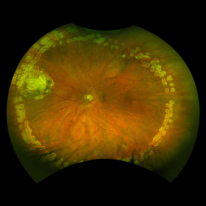 MonacoPro optomap farbe rg