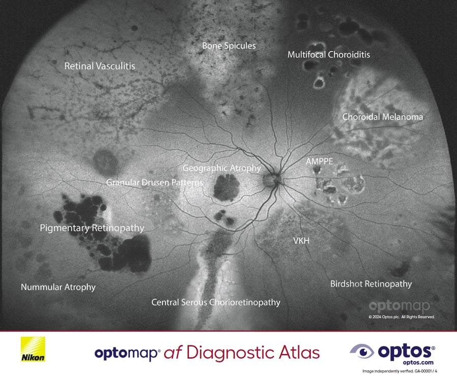 optomap af diagnostic atlas