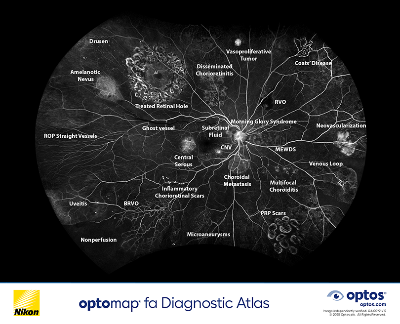 optomap fa diagnostic atlas