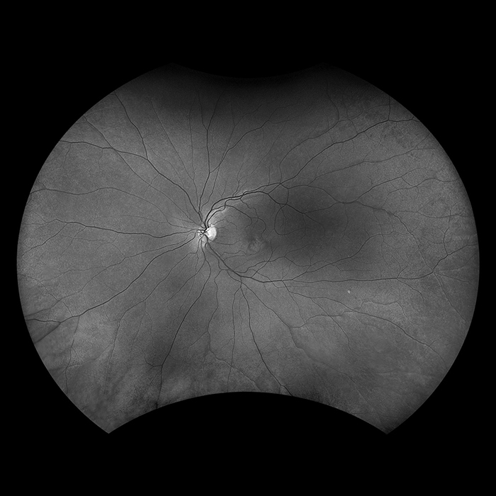 Silverstone optomap Sensorisch Rotfrei