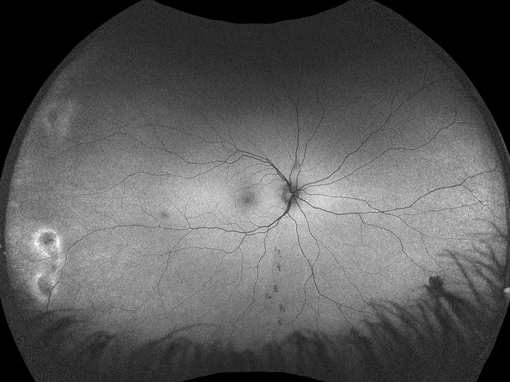 Autofluoreszenz