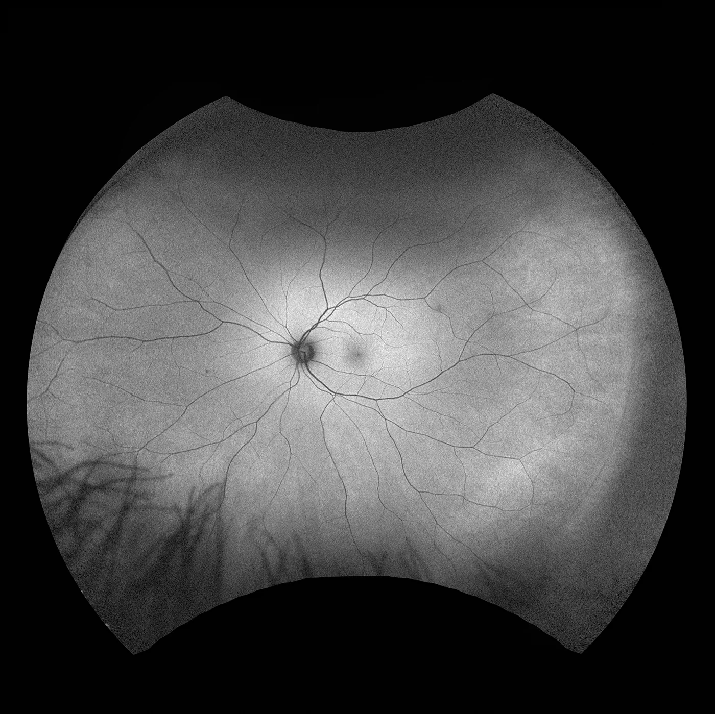 Autofluoreszenz